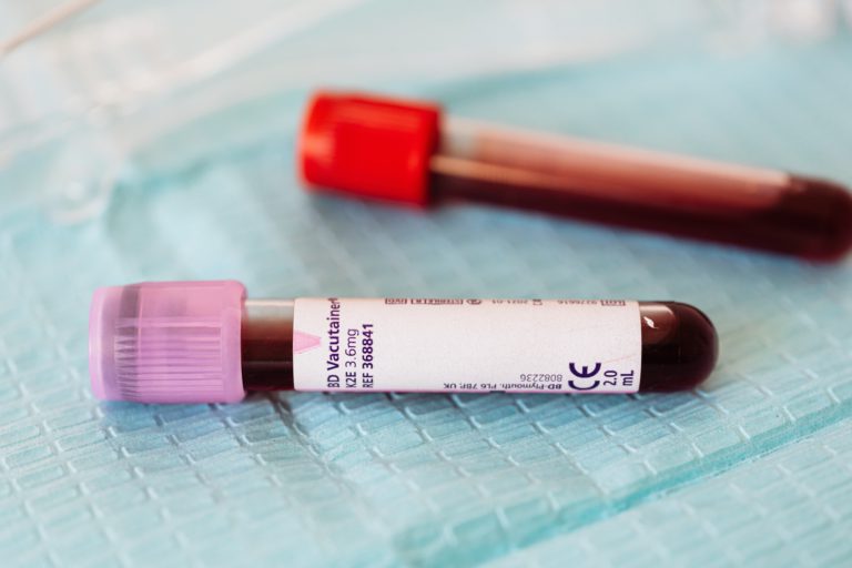 Read more about the article AST on a Blood Test: The Key Indicator You Should Know for Optimal Health