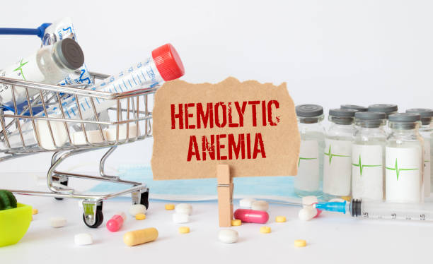 Read more about the article Breaking Down Hemolytic Anemia: Causes, Symptoms, and Treatment