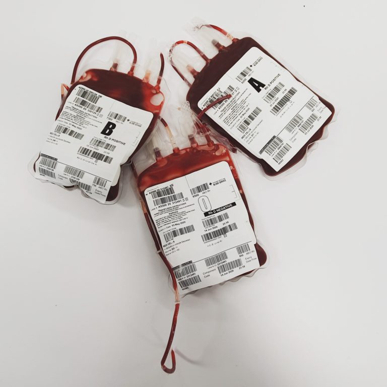 Read more about the article The Most Common Blood Type: What You Need to Know