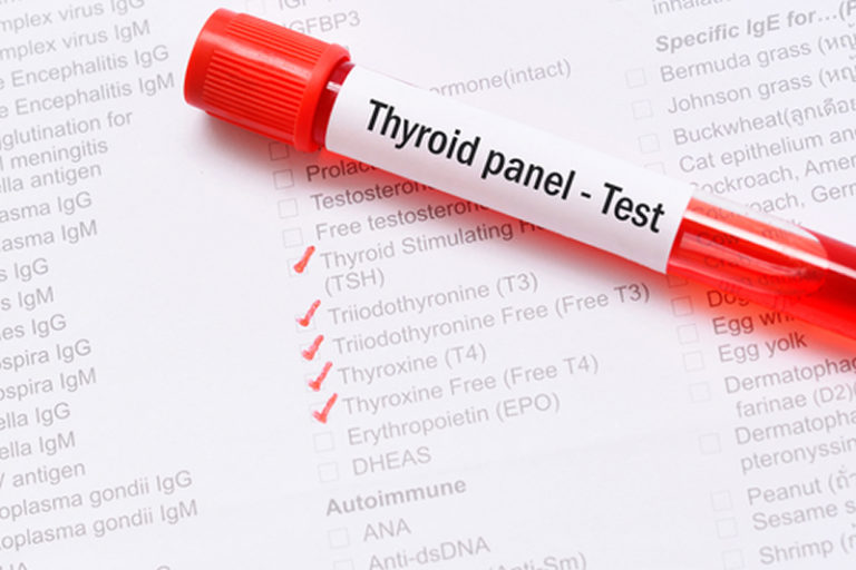 Read more about the article Thyroid Panel Test: A Comprehensive Guide to Thyroid Health