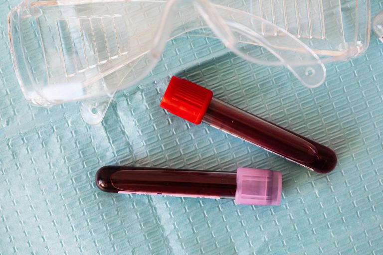 Read more about the article What Is a CMP Blood Test?