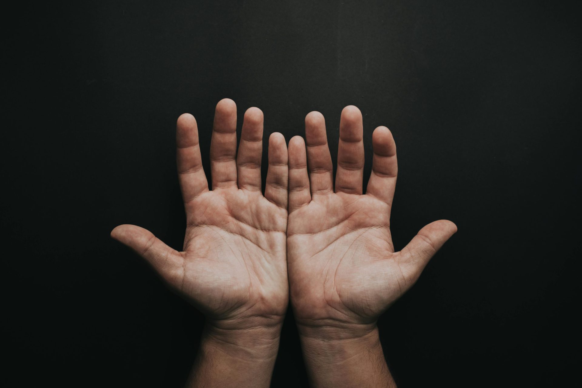 Read more about the article Why Are My Hands Always Sweaty? The Surprising Truth You Need to Know